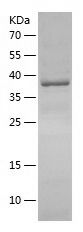 Recombinant Human DEK