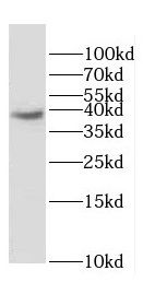 DOK6 antibody