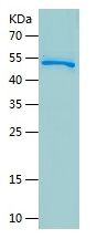 Recombinant Human SERPINB5