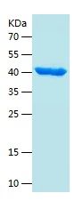 Recombinant Human B4GALT3