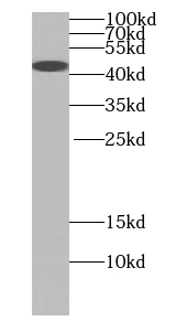 TTL antibody
