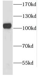 CSE1L antibody