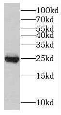 TNNI1 antibody