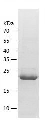 Recombinant Human LEPR