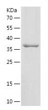 Recombinant Human USP49