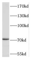 TACC2 antibody