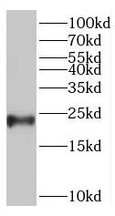 TNNI2 antibody