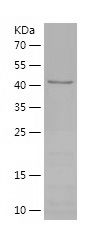 Recombinant Human CDK9