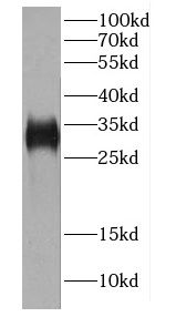 CA8 antibody