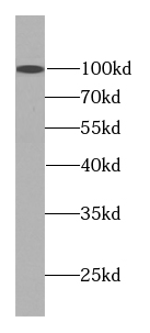 DSE antibody