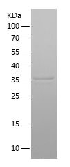 Recombinant Human PYGL