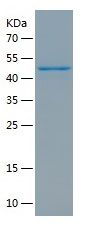 Recombinant Human GSDMB