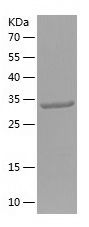 Recombinant Human SLC11A2