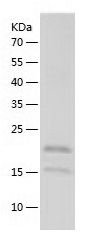 Recombinant Human IL-17A&17F