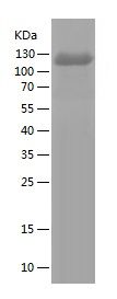 Recombinant Human M-CSF R