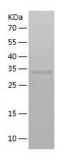 Recombinant Mouse Otc