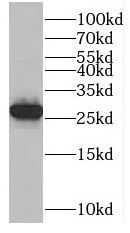 MAD2L1 antibody