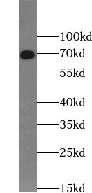 ZBTB44 antibody
