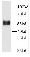 FETUB antibody