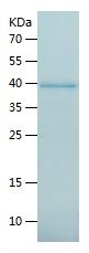 Recombinant Human ANXA2