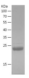 Recombinant Human TK1