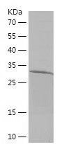 Recombinant Human CXCR7