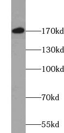 UGGT2 antibody