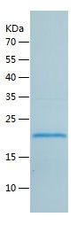 Recombinant Human GKN2