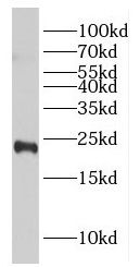 GGCT antibody