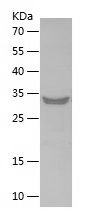 Recombinant Human GJB1
