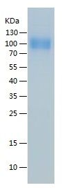 Recombinant Human CD32a (H167)