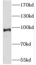 SLK antibody