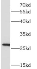 ARD1A antibody
