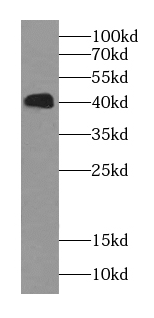 SH3GLB1 antibody