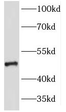 KRT23 antibody