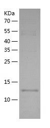 Recombinant Human TRAPPC2