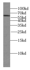 KGA/GAM/GAC antibody