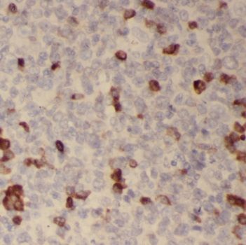 TLR3 antibody