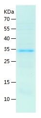 Recombinant Human SESN2