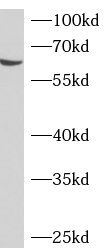 ADAD2 antibody