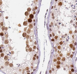 ADGRA1-Specific antibody