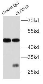 CLDN18 antibody