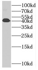 RRS1 antibody