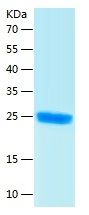 Recombinant Human RGS5