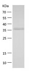 Recombinant Human SERPINB5