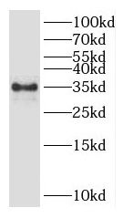 GLYAT antibody