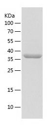 Recombinant Human VASP