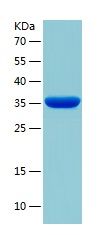 Recombinant Human RLIM