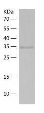 Recombinant Human ELP5