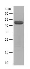 Recombinant Human CEP192